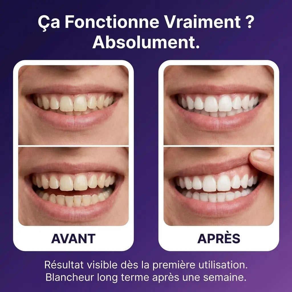 Bain De Bouche Blanchissant