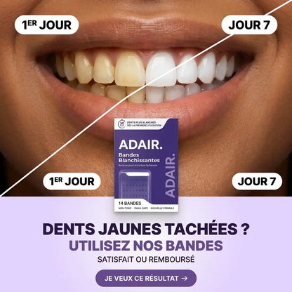 Bandes Blanchissantes Dentaires